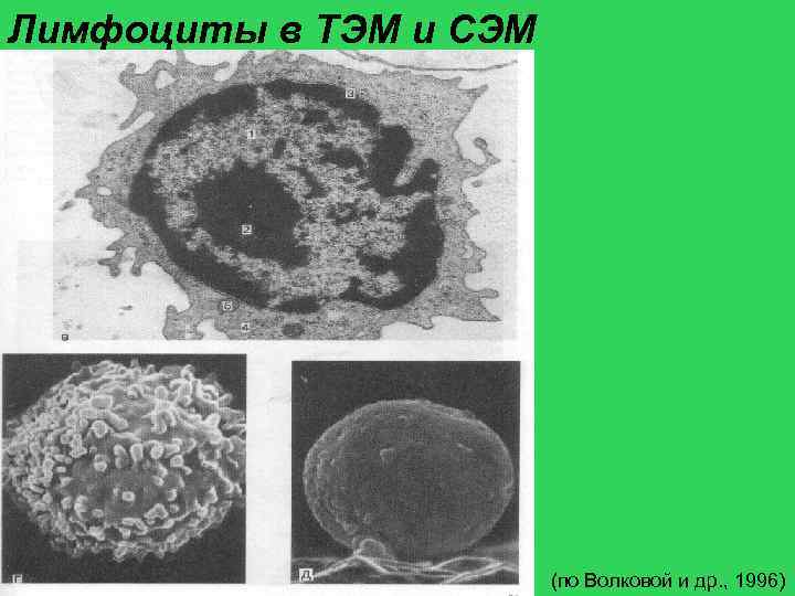 Лимфоциты в ТЭМ и СЭМ (по Волковой и др. , 1996) 