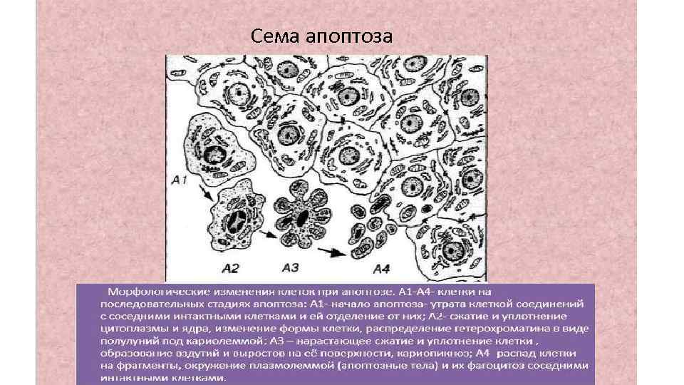 Морфологические изменения клеток. Морфологические изменения клеток при апоптозе. Изменение цитоплазмы при некрозе клетки. Апоптоз клетки.