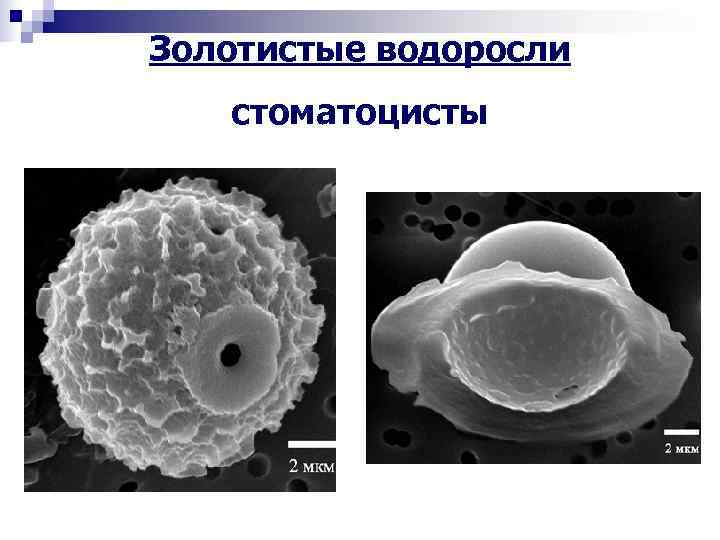 Золотистые водоросли стоматоцисты 