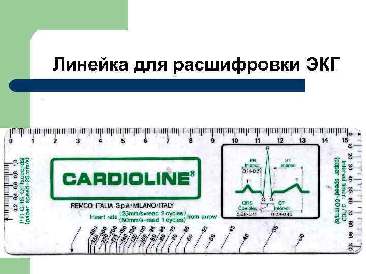  Линейка для расшифровки ЭКГ. 