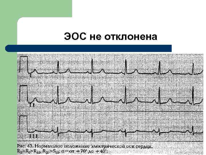 ЭОС не отклонена 