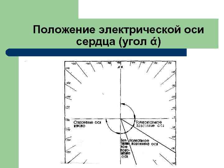  Положение электрической оси сердца (угол ά). 