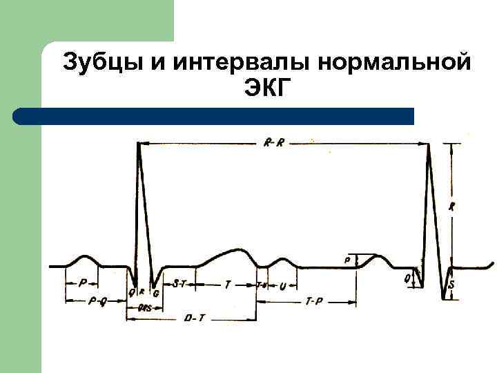  Зубцы и интервалы нормальной ЭКГ . 