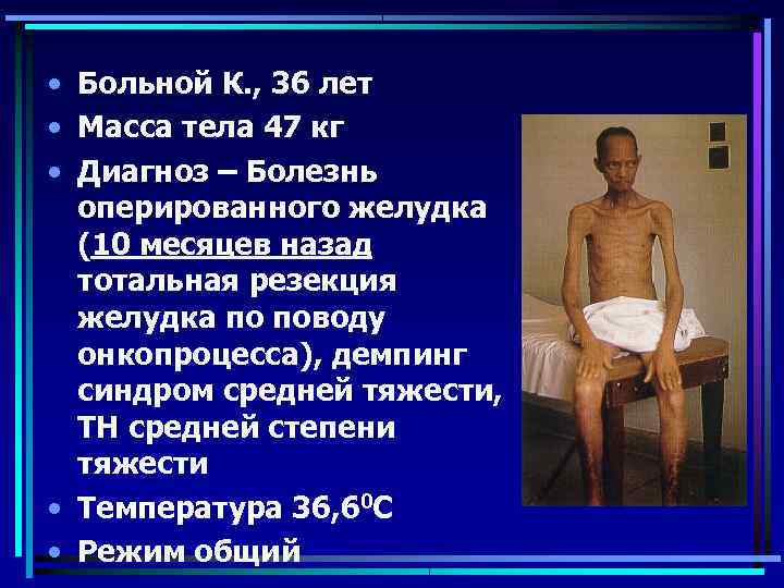  • Больной К. , 36 лет • Масса тела 47 кг • Диагноз