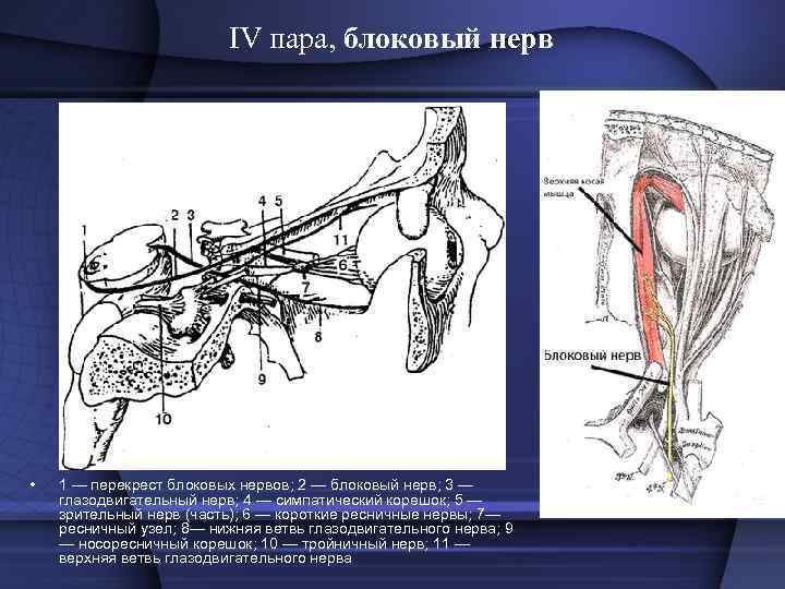  • При поражении блокового нерва  отмечается диплопия — двоение  предметов при