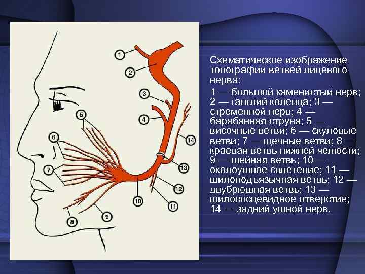  • При заболеваниях периферической части лицевого  нерва поражаются его ветви. Рот перетягивается