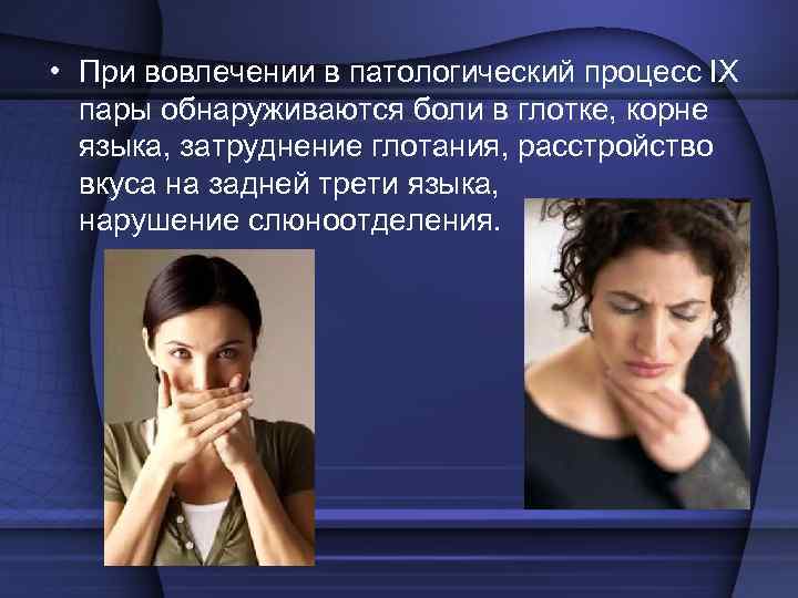   X пара – блуждающий нерв (лат. n. vagus) –   