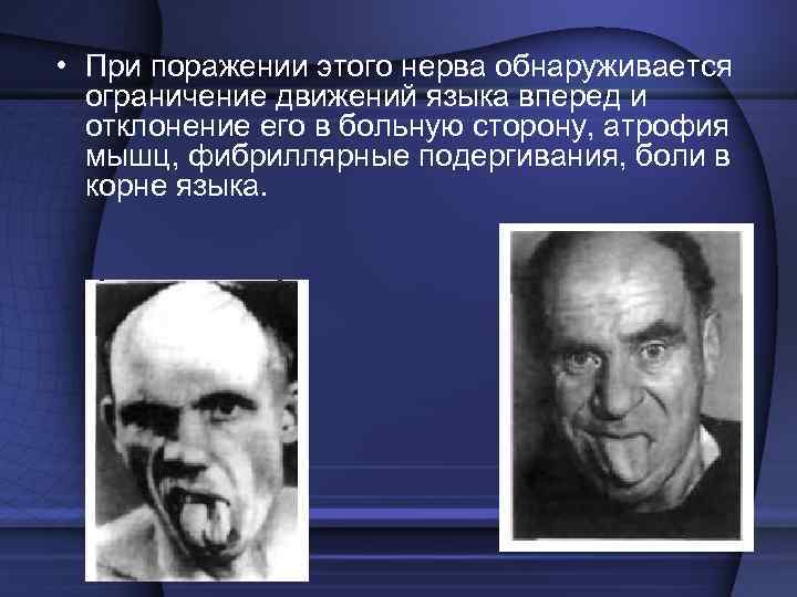 Система чувствительных нервов  представляет собой гомолог сегментарной чувствительности других участков тела, 