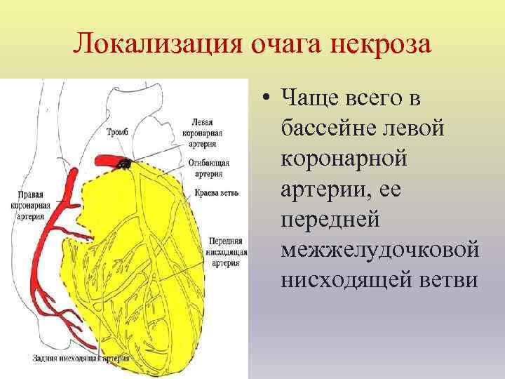 Локализация очага некроза • Чаще всего в бассейне левой коронарной артерии, ее передней межжелудочковой