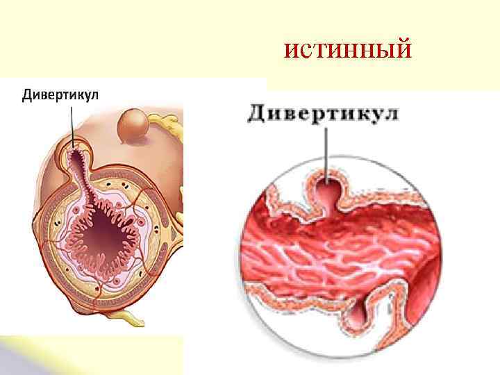  истинный 