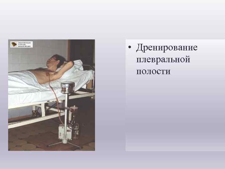  • Дренирование плевральной полости 