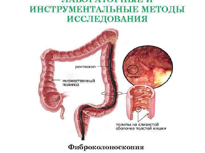 Тесты заболевания желудка