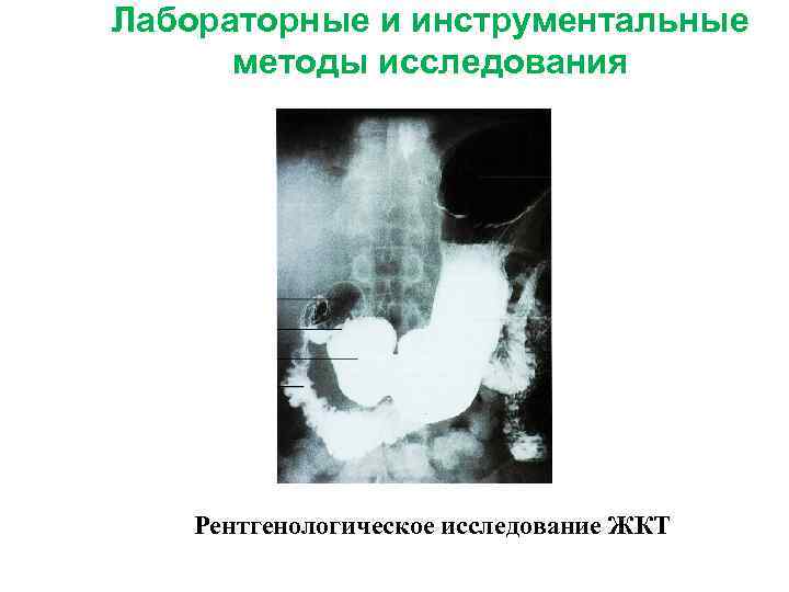 Лабораторные и инструментальные методы исследования Рентгенологическое исследование ЖКТ 