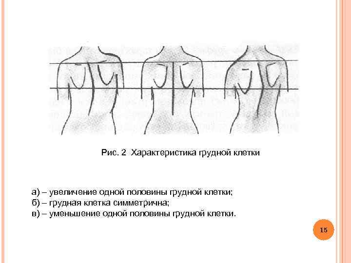  Рис. 2 Характеристика грудной клетки а) – увеличение одной половины грудной клетки; б)