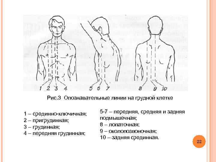  Рис. 3 Опознавательные линии на грудной клетке 1 – срединно-ключичная; 5 -7 –