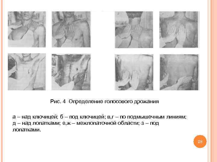  Рис. 4 Определение голосового дрожания а – над ключицей; б – под ключицей;