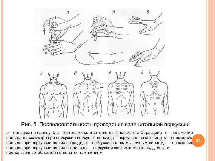  Рис. 5 Последовательность проведения сравнительной перкуссии а – пальцем по пальцу; б, в