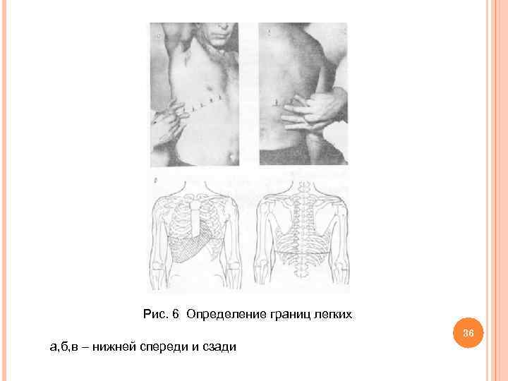  Рис. 6 Определение границ легких 36 а, б, в – нижней спереди и