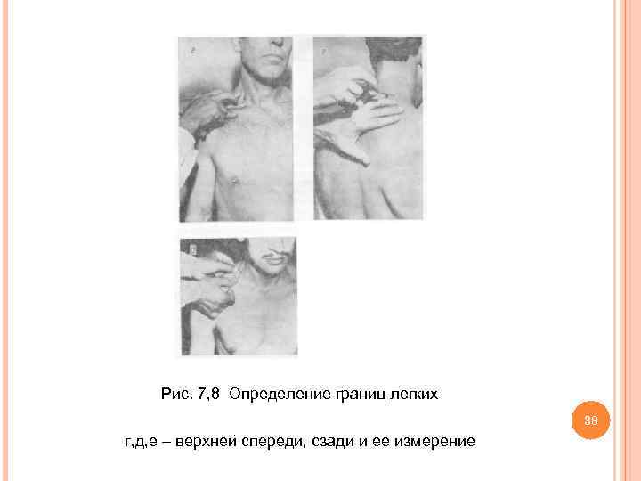  Рис. 7, 8 Определение границ легких 38 г, д, е – верхней спереди,