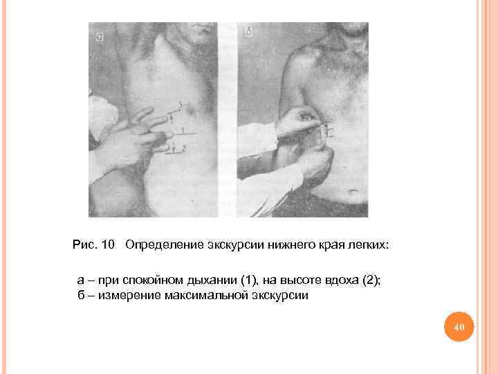 Рис. 10 Определение экскурсии нижнего края легких: а – при спокойном дыхании (1), на