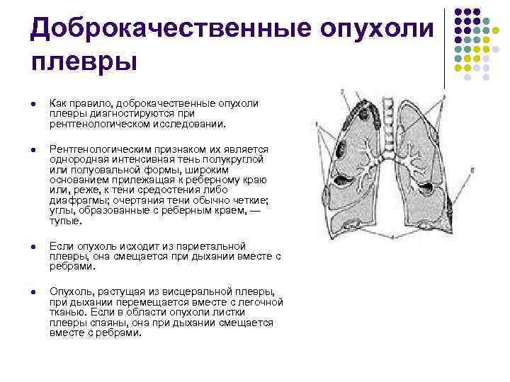 Части париетальной плевры