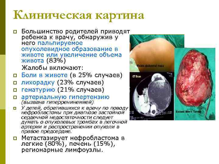 Клиническая картина p  Большинство родителей приводят ребенка к врачу, обнаружив у него пальпируемое