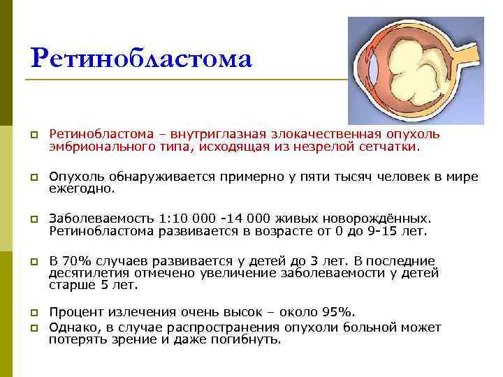 Ретинобластома у детей фото