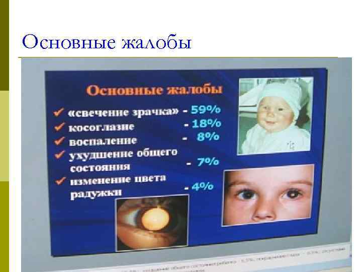 Основные жалобы 