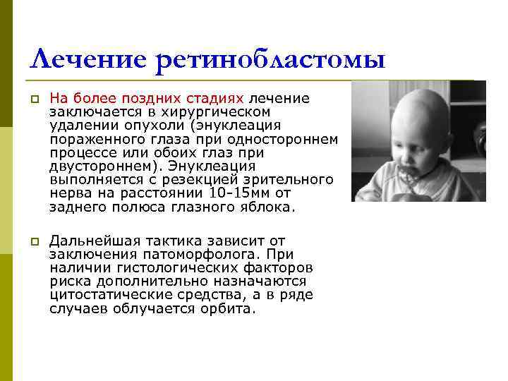 Лечение ретинобластомы p  На более поздних стадиях лечение заключается в хирургическом удалении опухоли