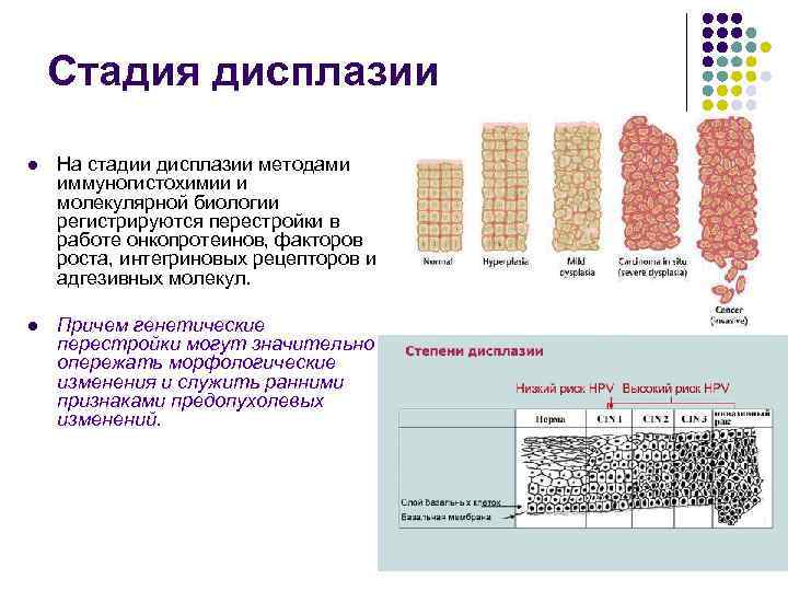   Стадия дисплазии l  На стадии дисплазии методами иммуногистохимии и молекулярной биологии