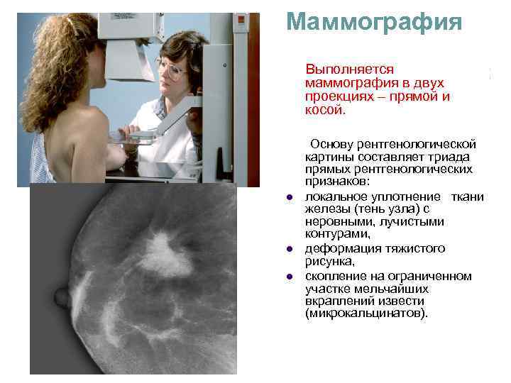 Маммография молочных желез как делают часто