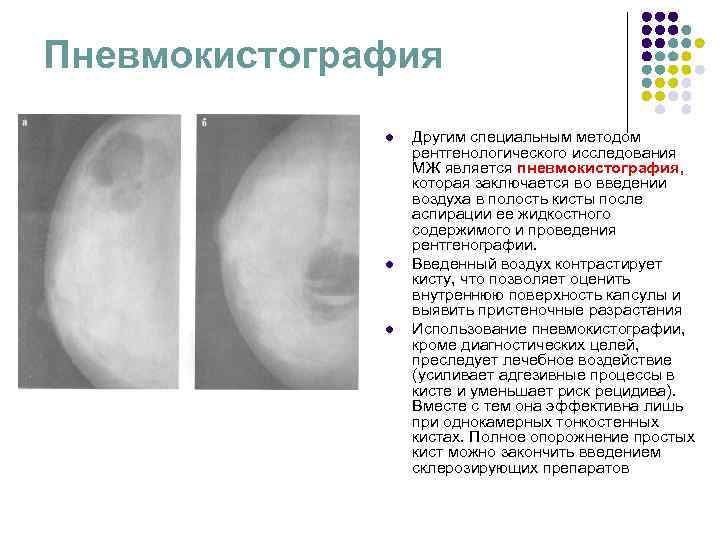 Химиотерапия рака молочной железы схемы лечения