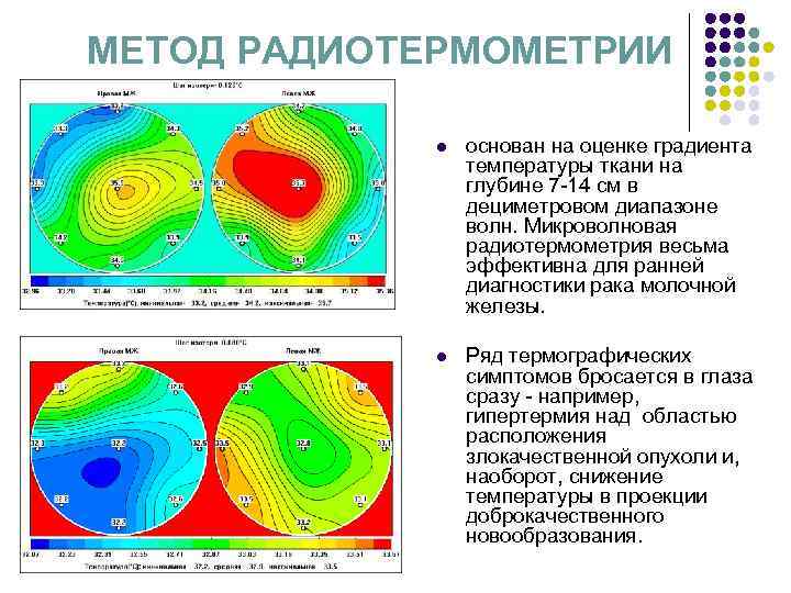 МЕТОД РАДИОТЕРМОМЕТРИИ l основан на оценке градиента МЕТОД РАДИОТЕРМОМЕТРИИ l основан на оценке градиента