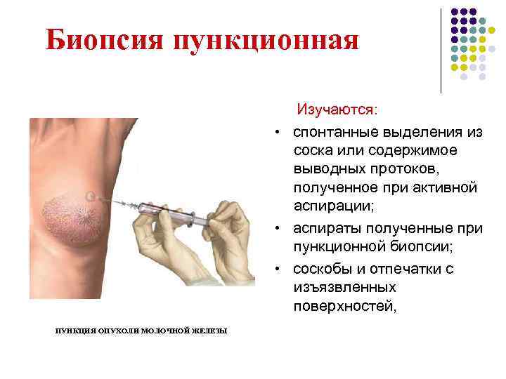 Биопсия пункционная Изучаются: Биопсия пункционная Изучаются: