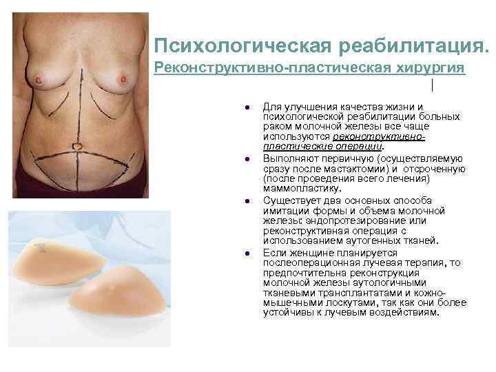 Психологическая реабилитация. Реконструктивно-пластическая хирургия l Для улучшения качества жизни и Психологическая реабилитация. Реконструктивно-пластическая хирургия l Для улучшения качества жизни и