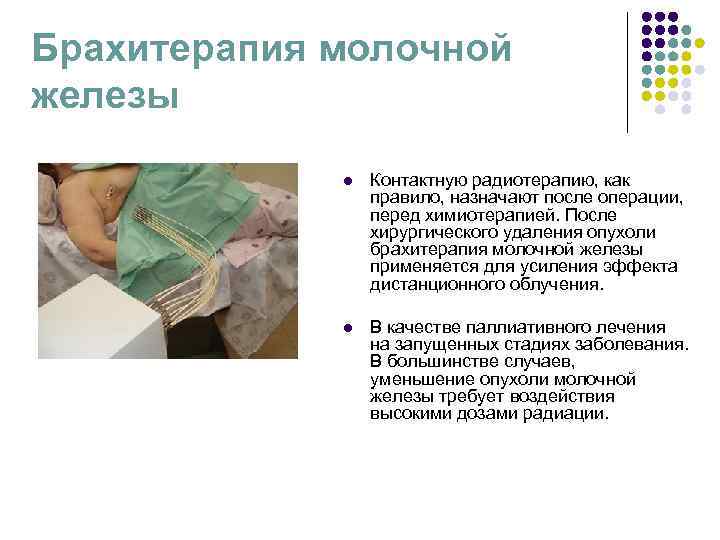 Брахитерапия молочной железы l Контактную радиотерапию, как Брахитерапия молочной железы l Контактную радиотерапию, как