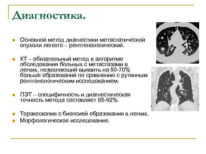 Диагностика. n Основной метод диагностики метастатической опухоли легкого – рентгенологический. n КТ – обязательный