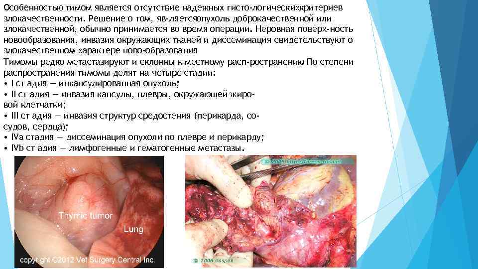 Особенностью тимом является отсутствие надежных гисто логическихкритериев злокачественности. Решение о том, яв ляетсяопухоль доброкачественной