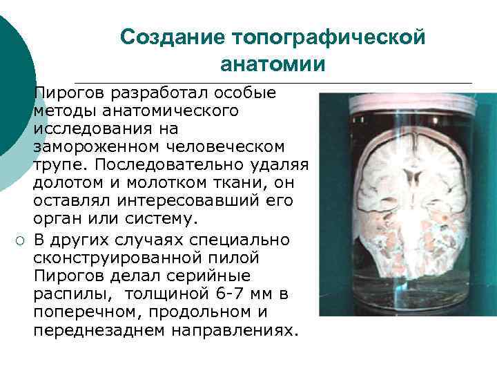  Создание топографической анатомии ¡ Пирогов разработал особые методы анатомического исследования на замороженном человеческом