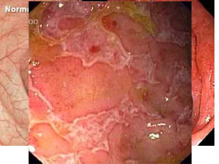   Классификация опухолей по стадиям:   (Петерсон Б. Е. , 1979; Трапезникова