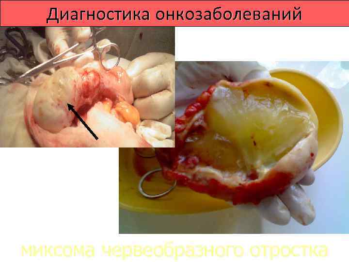  Диагностика онкозаболеваний    Компьютерная    рентгеновская  