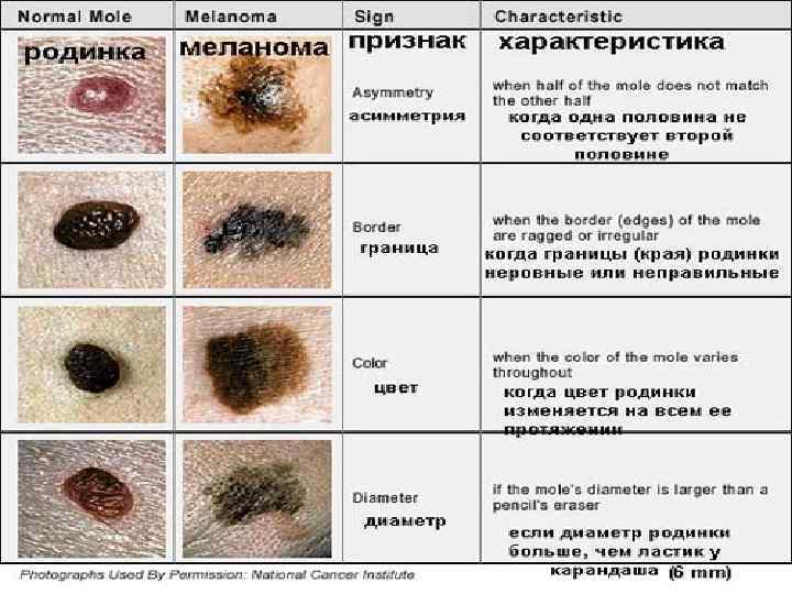   Диагностика онкозаболеваний • Лапароскопия • Торакоскопия • Медиастиноскопия 