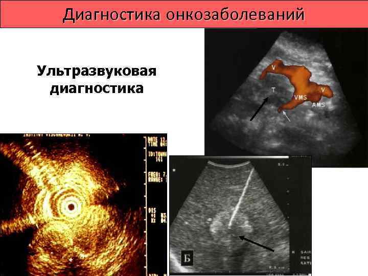  Диагностика онкозаболеваний Радиоинуклидная  диагностика 