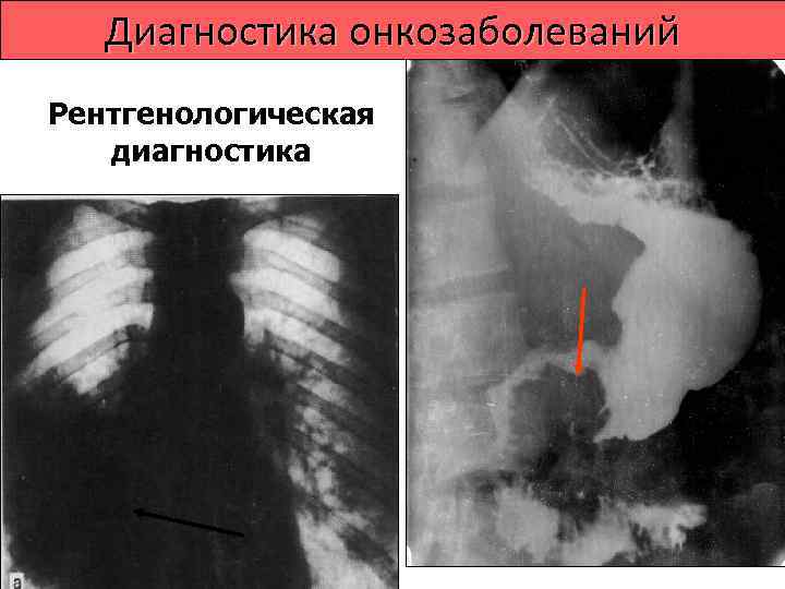   Диагностика онкозаболеваний  Верификация диагноза • Цитологическая  диагностика • Патоморфологическая 
