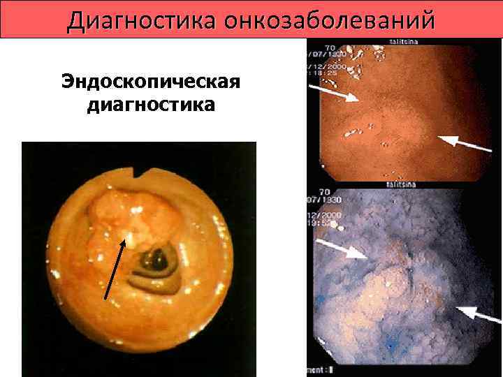   Лечение опухолей Лечение онкологических больных: • радикальное,  • паллиативное,  •