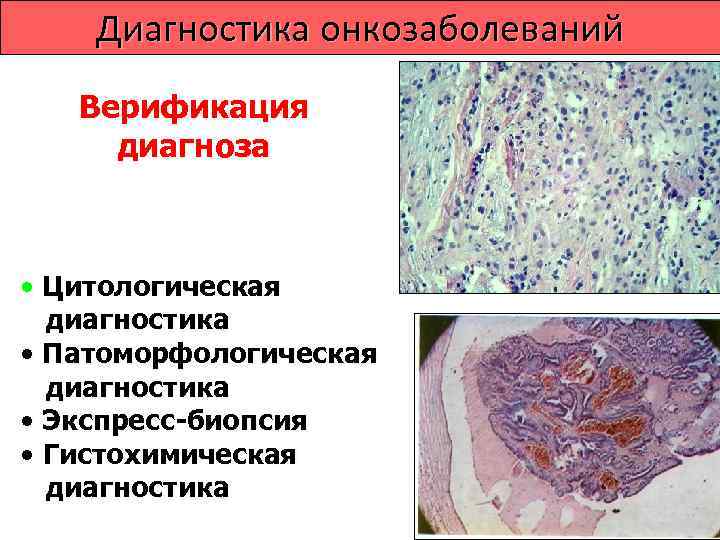   Лечение опухолей Методы лечения злокачественных    опухолей:  • Один