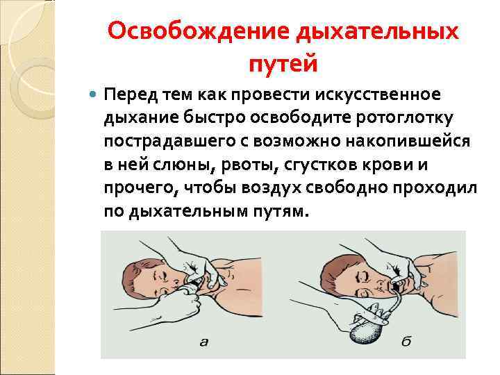   Освобождение дыхательных   путей Перед тем как провести искусственное дыхание быстро