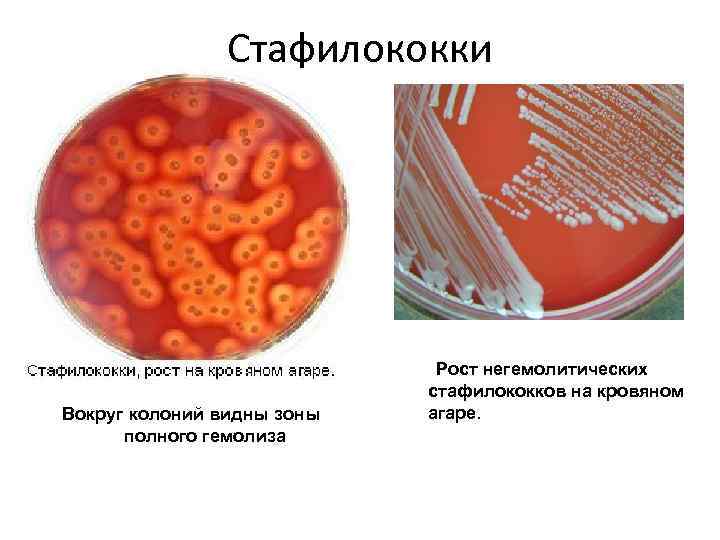     Стафилококки       Рост негемолитических 