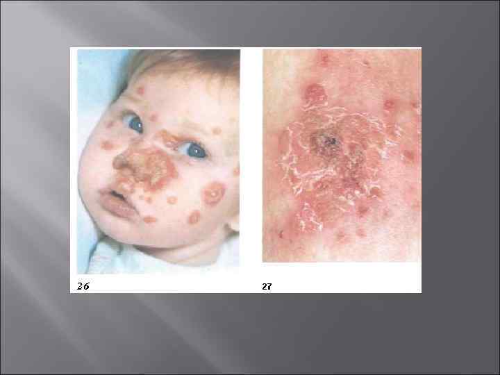   Иммунитет:  • гуморальный и клеточный;  • антимикробный и антитоксический •