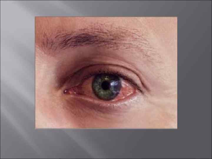    Микробиологическая   диагностика 1. Бактериологический (культуральный) метод  - основной;